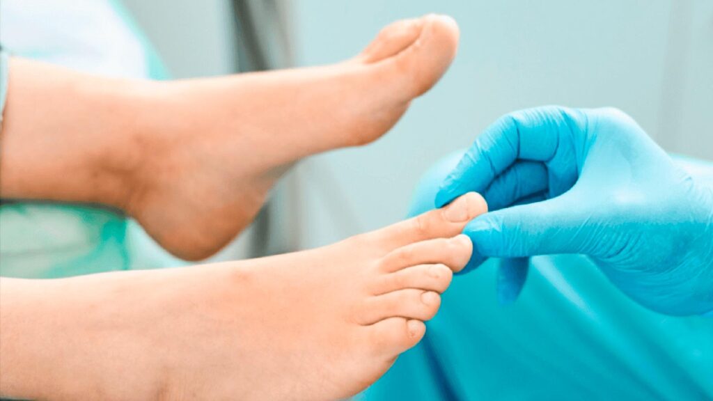 Causas y Tratamientos de Uñas Encarnadas